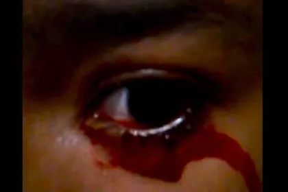 Zharick Ramirez's Tears of Blood