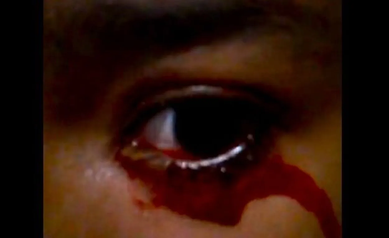 Zharick Ramirez's Tears of Blood