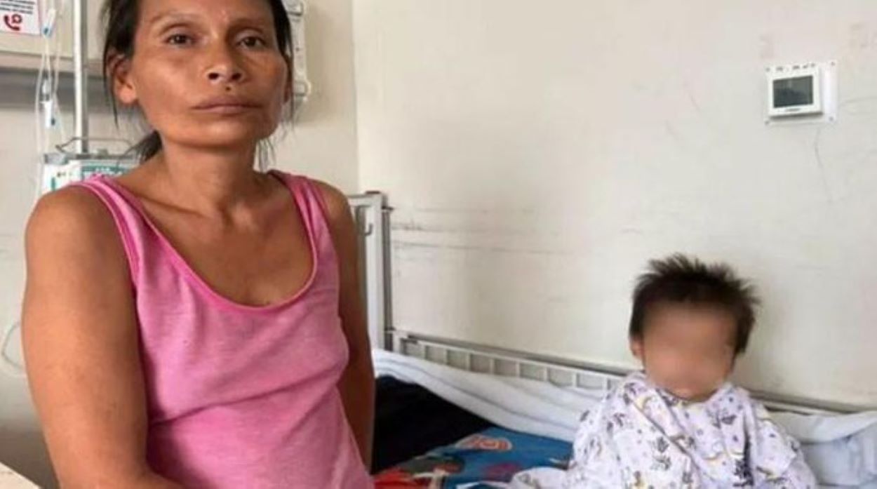 Toddler Swallows Needles in Peru