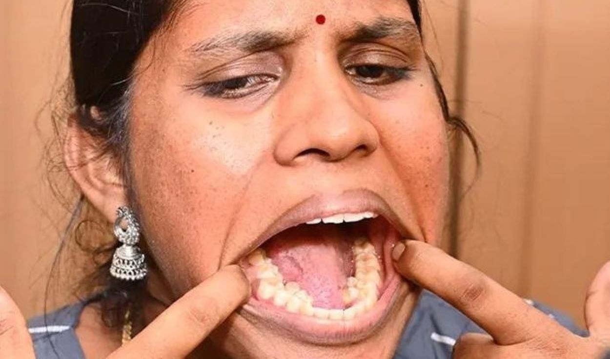 Most Teeth Guinness World Record