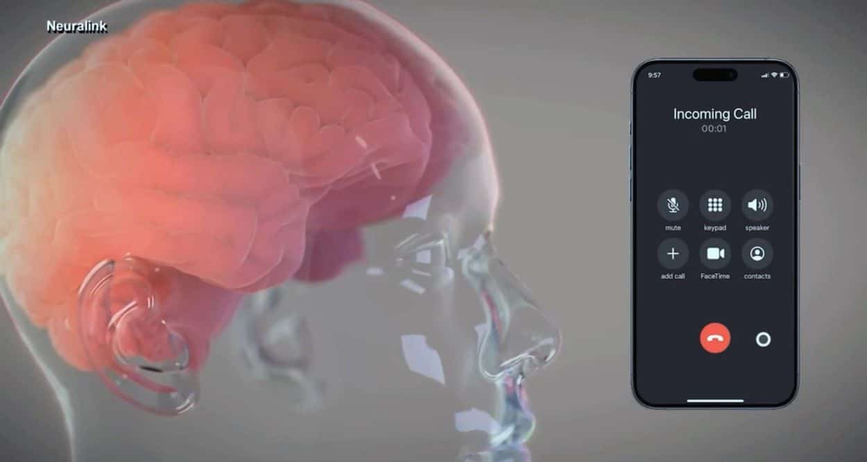 Neuralink Human Brain-Chip Implant