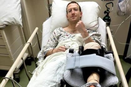 mark zuckerberg Injury