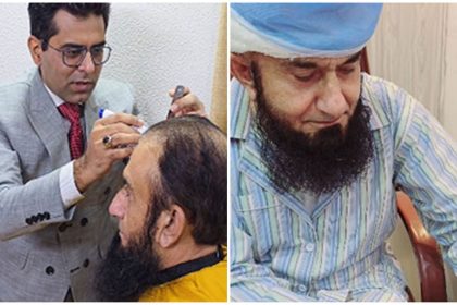 Maulana Tariq Jameel Hair Transplant