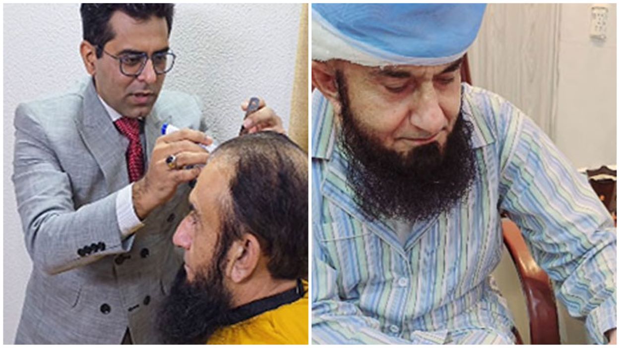 Maulana Tariq Jameel Hair Transplant