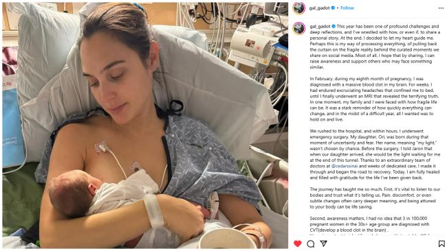 Gal Gadot Brain Surgery in Pregnancy, Shares Recovery Journey