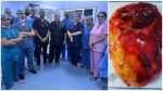 Safdarjung Hospital in New Delhi World’s Largest Adrenal Tumour