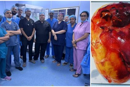 Safdarjung Hospital in New Delhi World’s Largest Adrenal Tumour