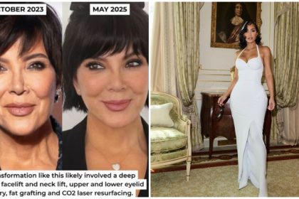 Kris Jenner Kim Kardashian surgery