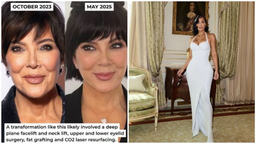 Kris Jenner Kim Kardashian surgery