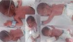 Karachi quintuplets birth 2025