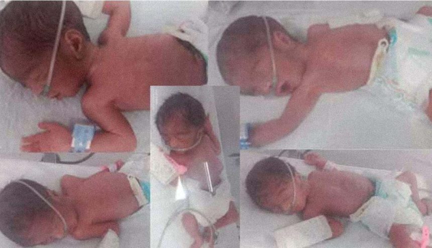 Karachi quintuplets birth 2025
