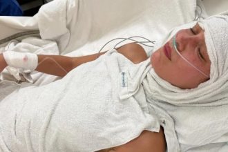 Bella Hadid Lyme disease