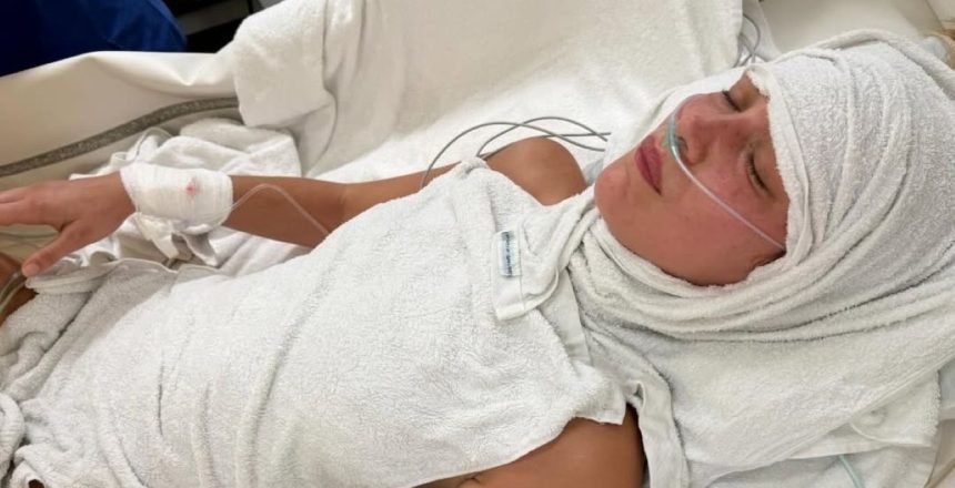 Bella Hadid Lyme disease