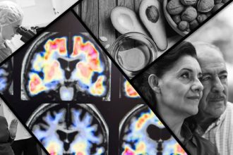 Alzheimer's disease research