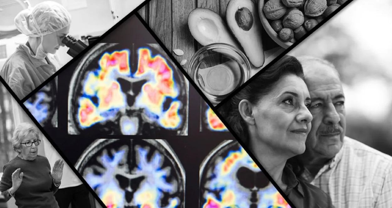 Alzheimer's disease research