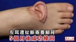 Chinese surgeons ear reattachment foot