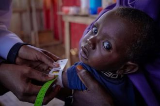 A health worker uses a measuring tape to check a young child’s upper arm during a malnutrition screening in Somalia.