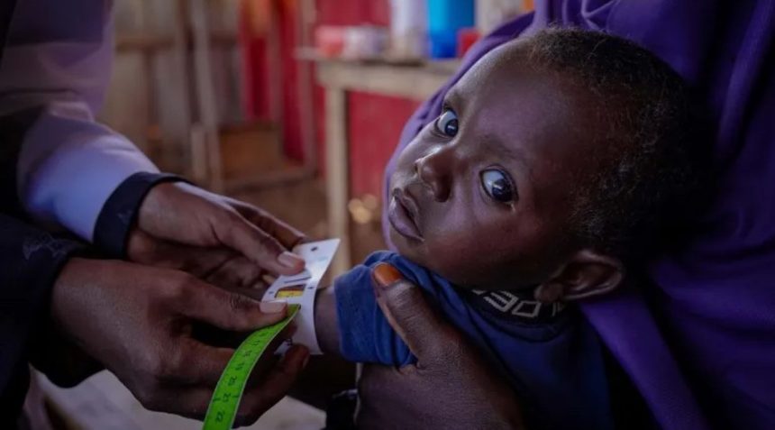 A health worker uses a measuring tape to check a young child’s upper arm during a malnutrition screening in Somalia.