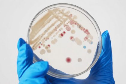 Vibrio vulnificus infections shown in a laboratory culture