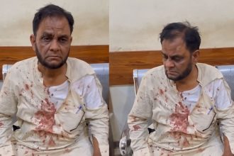 University of Karachi professor Muhammad Arif Khan Saqi after alleged road-rage assault in Safoora Goth